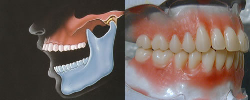Studio Dentistico Laura Leo - Terapie - GNATOLOGIA
